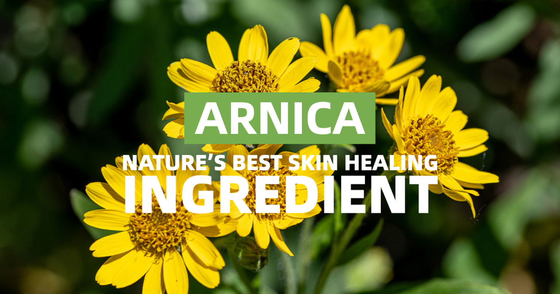 Arnica: Nature's Best Pain Reliever